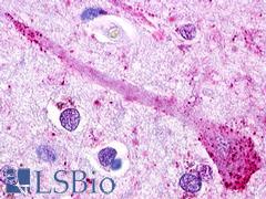 GPR49 / LGR5 Antibody - Brain, Cortex, Neuron