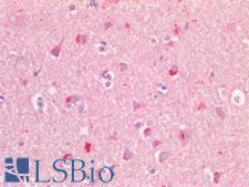 GPR49 / LGR5 Antibody - Human Brain, Cortex: Formalin-Fixed, Paraffin-Embedded (FFPE)