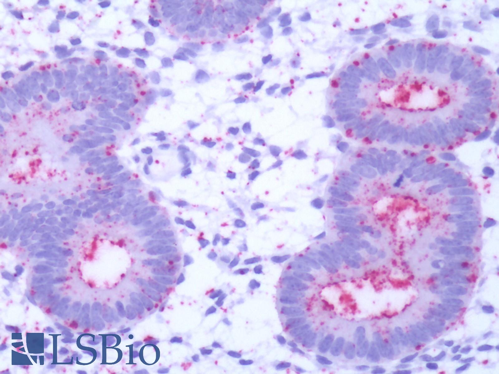 GPR50 Antibody - Human Uterus, Endometrium: Formalin-Fixed, Paraffin-Embedded (FFPE)