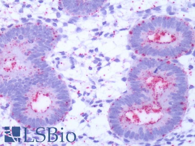 GPR50 Antibody - Human Uterus, Endometrium: Formalin-Fixed, Paraffin-Embedded (FFPE)