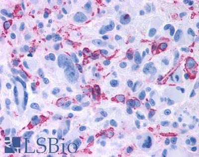 GPR50 Antibody - Brain, Glioblastoma
