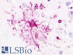 GPR52 Antibody - Brain, Cortex neurons and glia