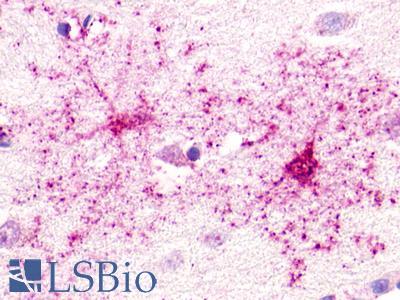 GPR52 Antibody - Brain, Putamen, neurons and glia