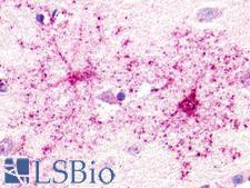GPR52 Antibody - Brain, Putamen, neurons and glia