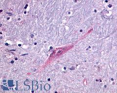 GPR55 Antibody - Brain, Globus Pallidus