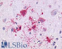 GPR55 Antibody - Brain, Alzheimer's disease, neurons and glia