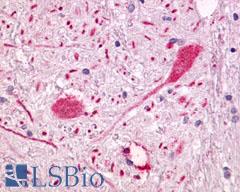 GPR55 Antibody - Brain, Globus Pallidus