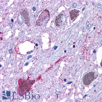 GPR6 Antibody - Brain, Substantia nigra