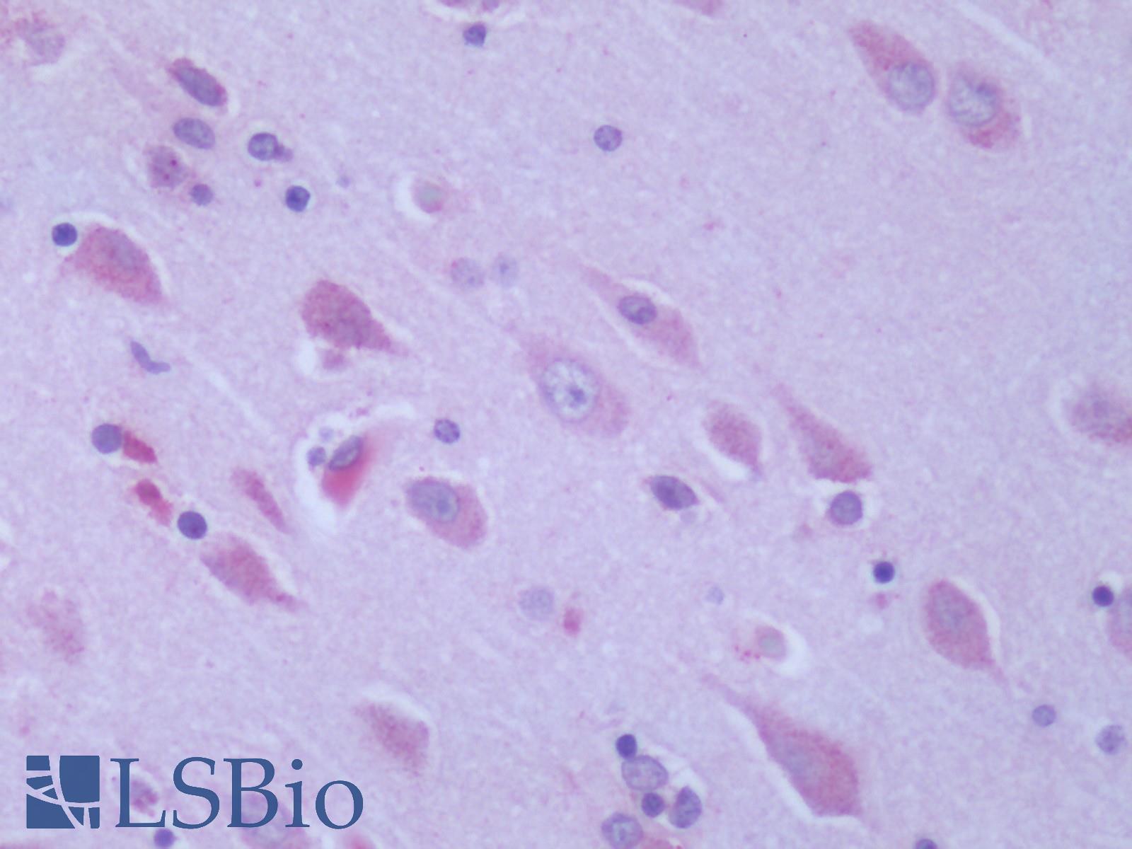 GPR6 Antibody - Human Brain, Cortex: Formalin-Fixed, Paraffin-Embedded (FFPE)