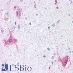 GPR6 Antibody - Brain, Thalamus, neurons