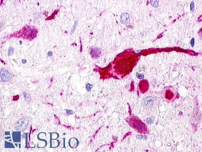GPR62 Antibody - Brain, Hypothalamus, neurons