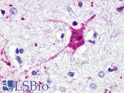 GPR62 Antibody - Brain, Amygdala, neurons 