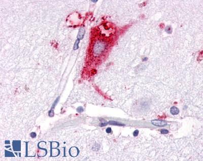 GPR63 Antibody - Anti-GPR63 antibody IHC of human brain, neurons and glia. Immunohistochemistry of formalin-fixed, paraffin-embedded tissue after heat-induced antigen retrieval.