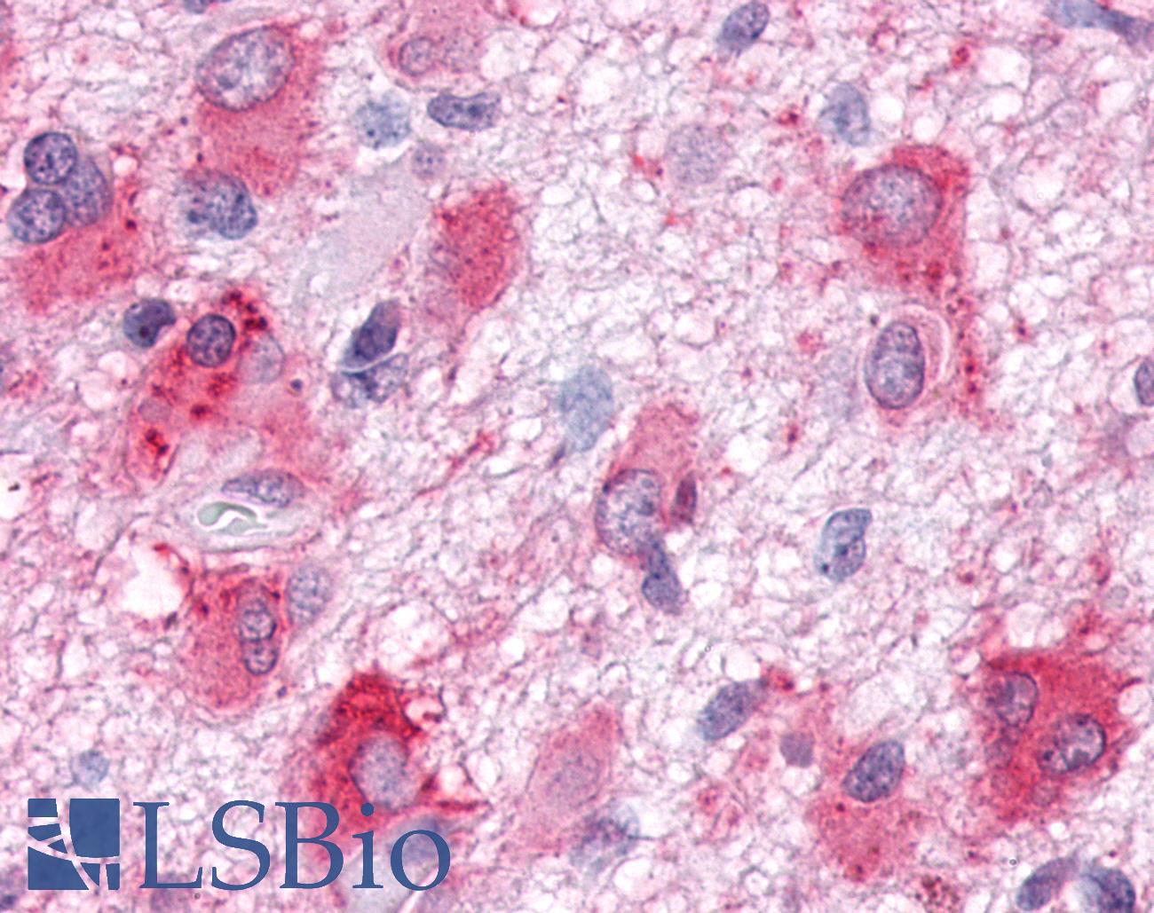 GPR63 Antibody - Brain, Glioblastoma