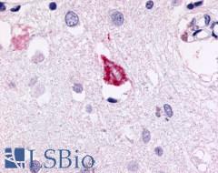 GPR78 Antibody - Brain, Alzheimer's disease, neurofibrillary tangle