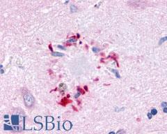GPR78 Antibody - Brain, Alzheimer's disease, senile plaque