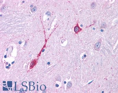 GPR80 / GPR99 / OXGR1 Antibody - Brain, Caudate, neurons and glia