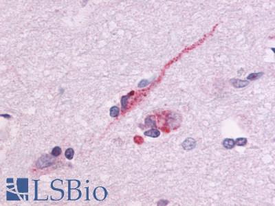 GPR83 Antibody - Brain, Amygdala