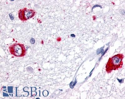 GPR83 Antibody - Brain, Thalamus, neurons