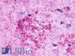 GPR84 Antibody - Brain, Alzheimer's disease, senile plaque