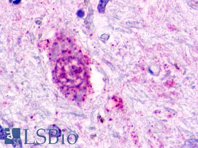 GPR84 Antibody - Brain, substantia nigra