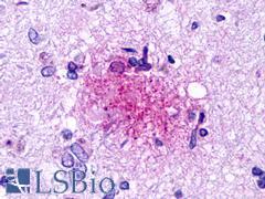 GPR84 Antibody - Brain, Alzheimer's disease, senile plaque