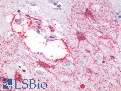 GPR87 Antibody - Brain, Caudate neurons