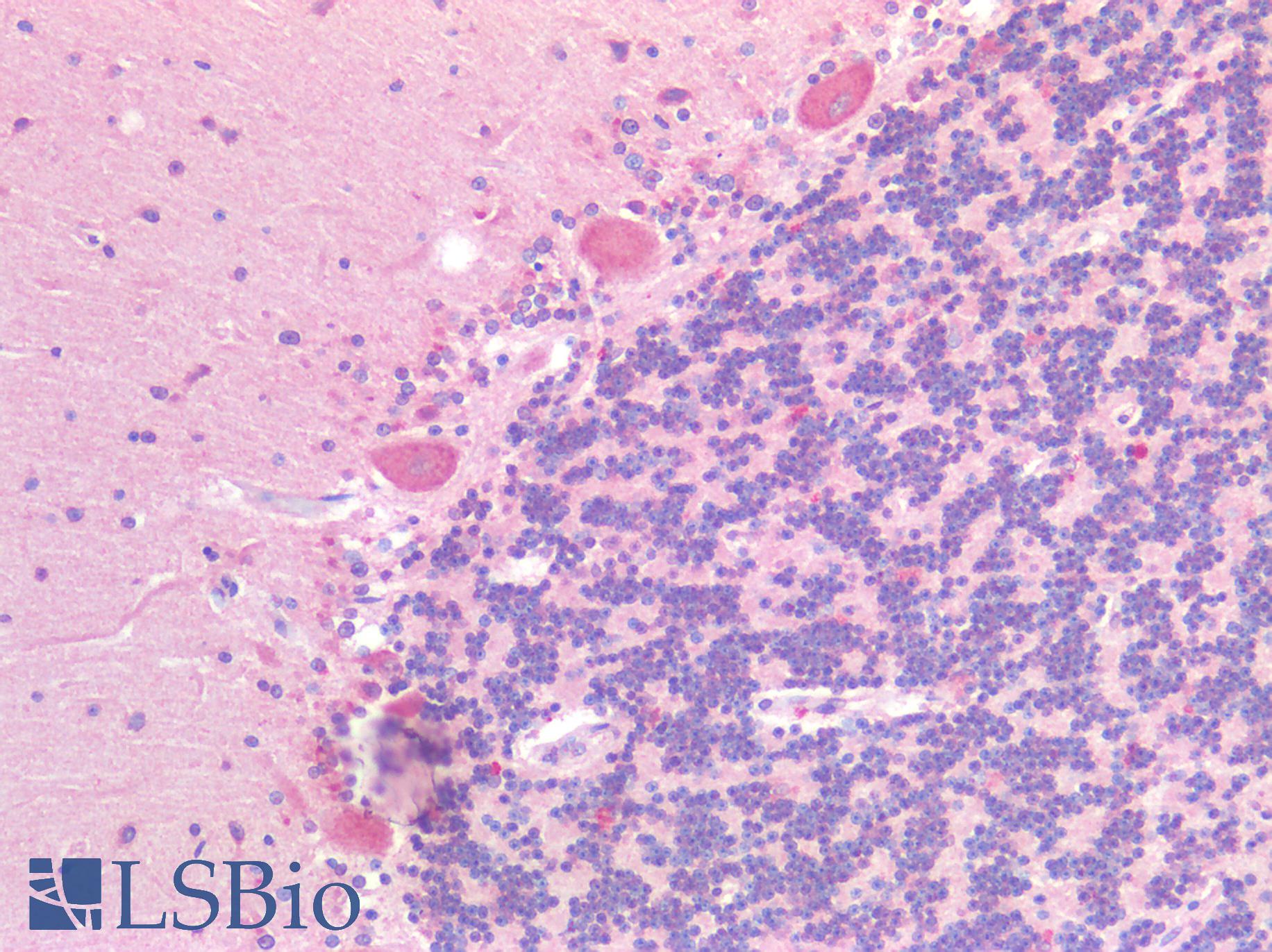 GPR87 Antibody - Human Brain, Cerebellum: Formalin-Fixed, Paraffin-Embedded (FFPE)