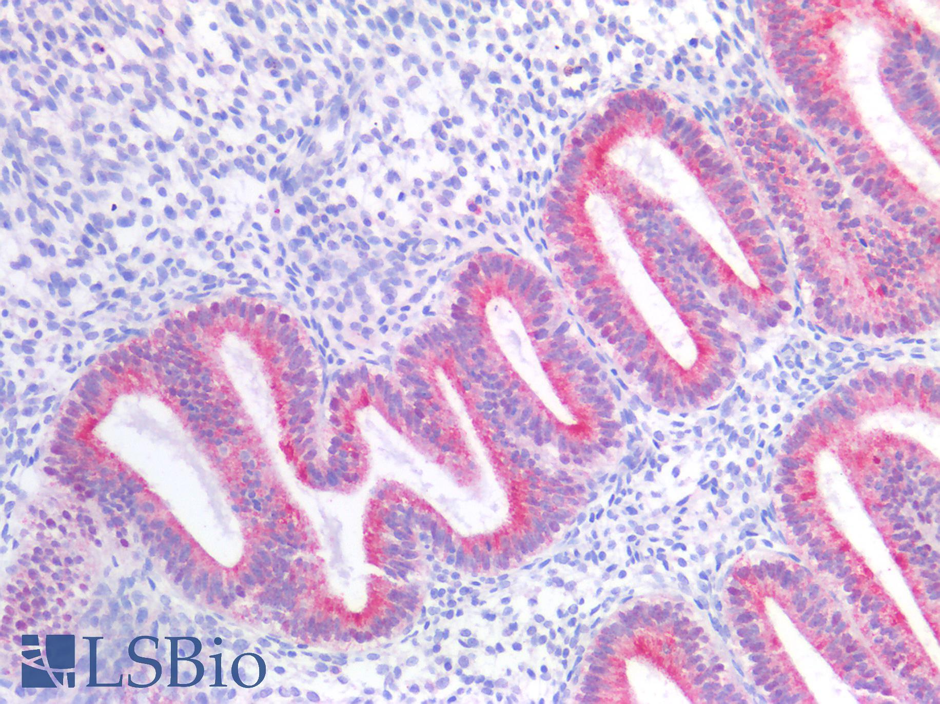 GPR87 Antibody - Human Uterus: Formalin-Fixed, Paraffin-Embedded (FFPE)