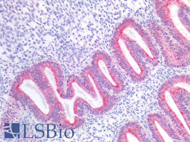 GPR87 Antibody - Human Uterus: Formalin-Fixed, Paraffin-Embedded (FFPE)