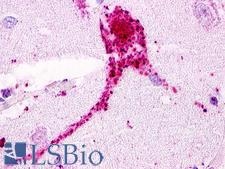 GPRC5D Antibody - Brain, Amygdala, Neurons and Glia