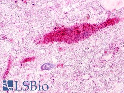 GPRC5D Antibody - Brain, Substantia nigra