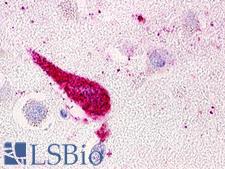 GPRC5D Antibody - Brain, Caudate, Neurons and Glia