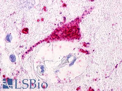 GPRC5D Antibody - Brain, Amygdala, neurons and glia