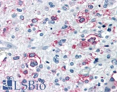 GPRC6A Antibody - Brain, Glioblastoma