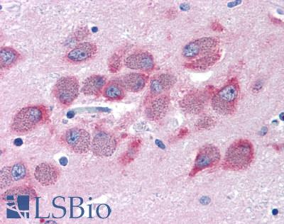 GPRC6A Antibody - Brain, Hypothalamus, neurons of the tuberal nucleus
