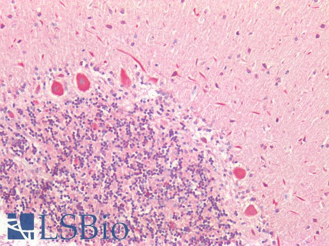GRB7 Antibody - Human Brain, Cerebellum: Formalin-Fixed, Paraffin-Embedded (FFPE)