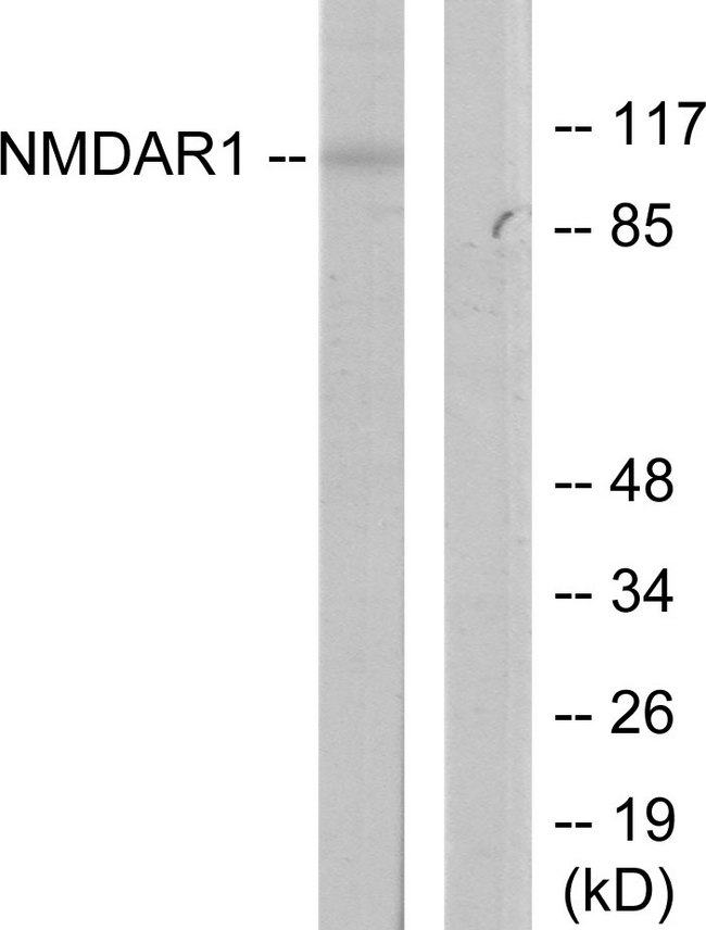 GRIN1 / NMDAR1 Antibody - Western blot analysis of lysates from Jurkat cells, using NMDAR1 Antibody. The lane on the right is blocked with the synthesized peptide.