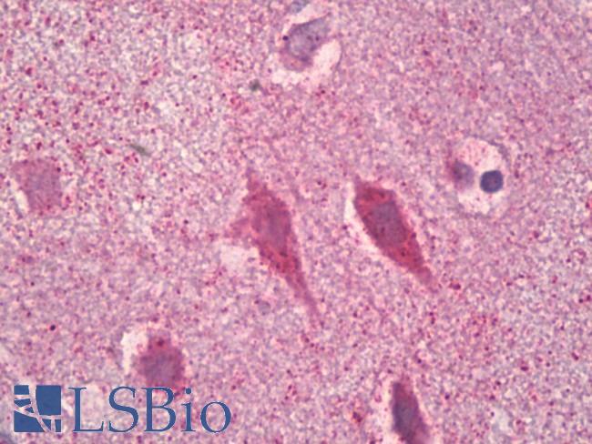 GRIN1 / NMDAR1 Antibody - Anti-GRIN1 / NMDAR1 antibody IHC of human brain, cortex neurons. Immunohistochemistry of formalin-fixed, paraffin-embedded tissue after heat-induced antigen retrieval. Antibody dilution 1:100.