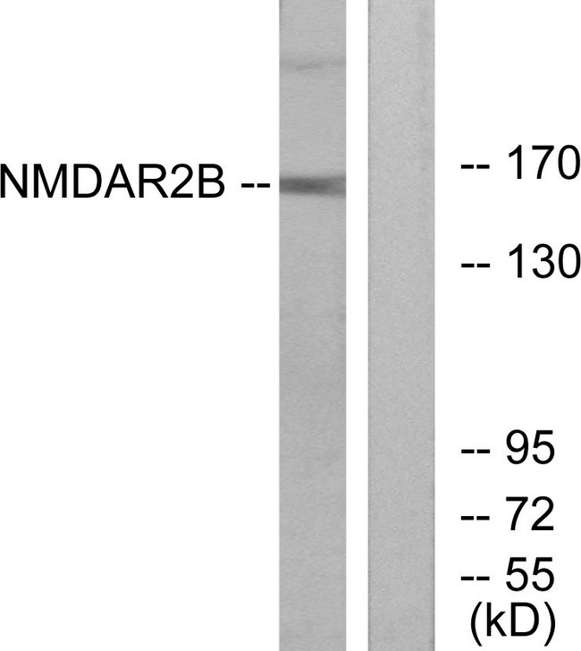 GRIN2B / NMDAR2B / NR2B Antibody - Western blot analysis of lysates from Jurkat cells, using NMDAR2B Antibody. The lane on the right is blocked with the synthesized peptide.