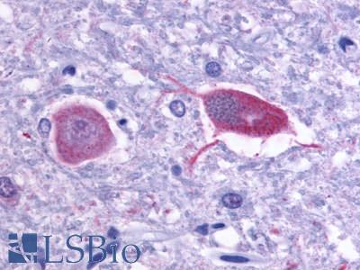 GRM1 / MGLUR1 Antibody - Brain, Thalamus, neurons