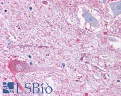 GRM2 / MGLUR2 Antibody - Brain, medulla