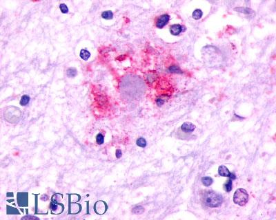 GRM2 / MGLUR2 Antibody - Brain, Alzheimer's disease, senile plaque