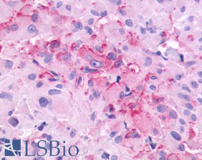 GRM3 / MGLUR3 Antibody - Brain, glioblastoma