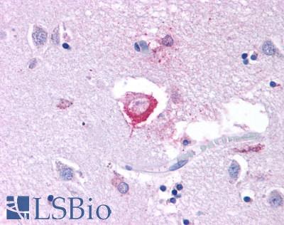 GRM3 / MGLUR3 Antibody - Brain, Caudate