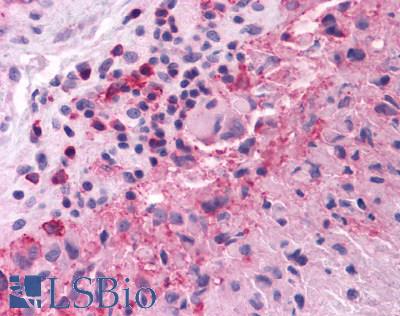 GRM3 / MGLUR3 Antibody - Brain, Glioblastoma
