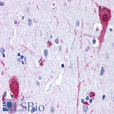 GRM4 / MGLUR4 Antibody - Brain, cortex neurons