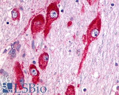 GRM5 / MGLUR5 Antibody - Brain, Hypothalamus