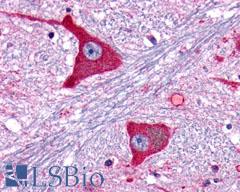 GRM5 / MGLUR5 Antibody - brain, Medulla, neurons