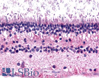 GRM6 / MGLUR6 Antibody - Eye, Retina